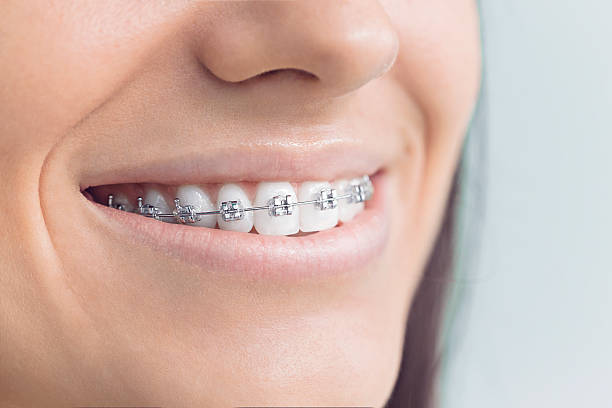 Best Traditional Braces  in Goliad, TX